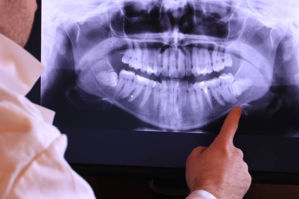 Best Emergency Tooth Extraction in La Verkin, UT